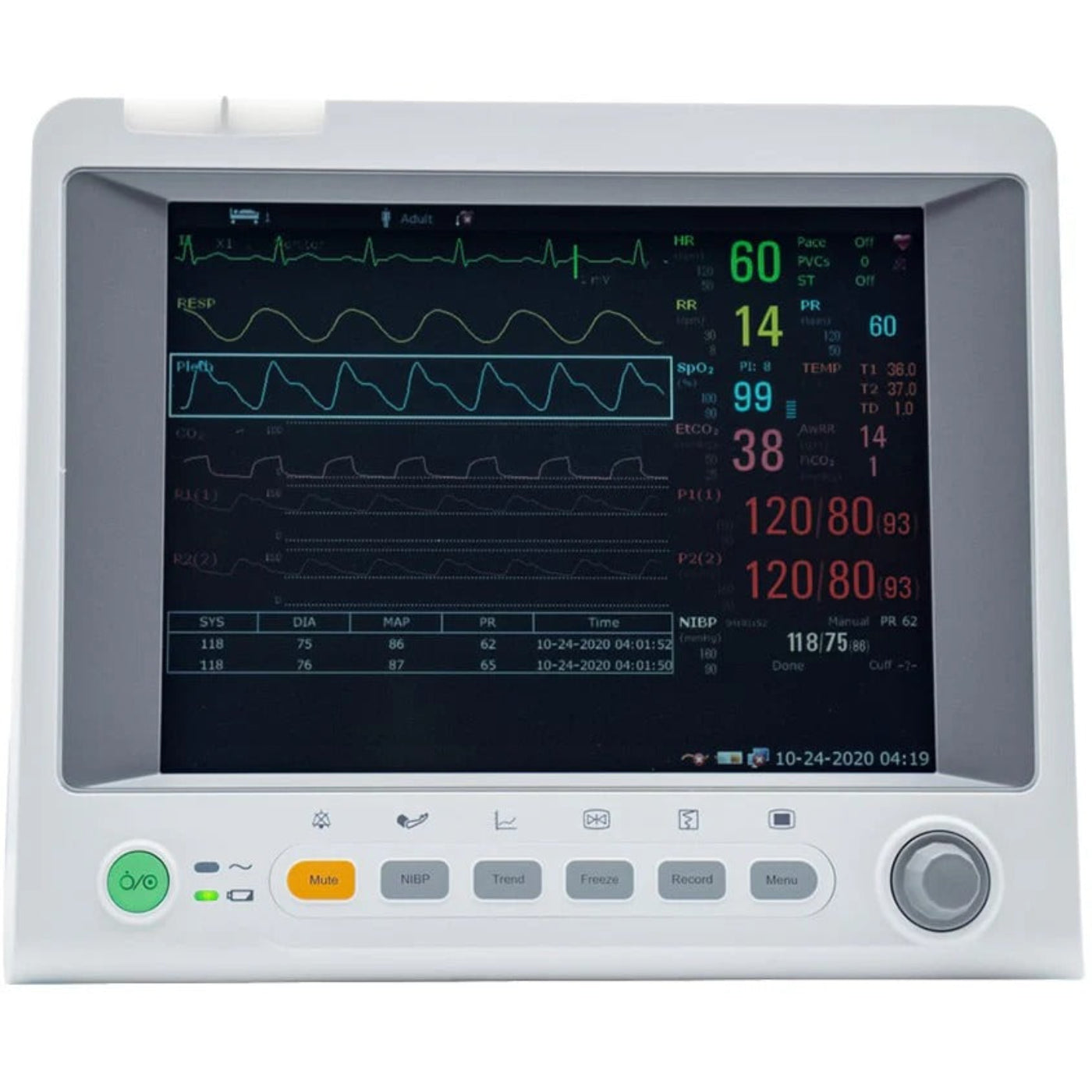Edan iM60 Patient Monitor -  EDN-iM60-Touch-WiFi